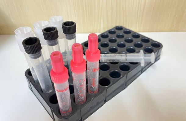 Das Bild zeigt Labormaterial