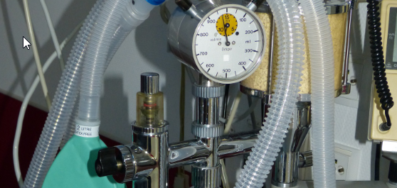 Der Bildschirm eines Laptops zeigt Details eines Narkoseger&auml;tes