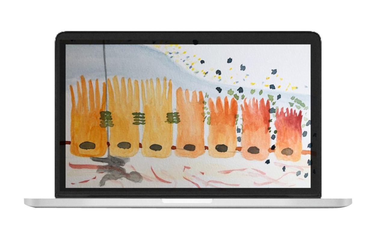 Der Bildschirm eines Laptops zeigt die Zeichnung von einer Darmschleimhaut.