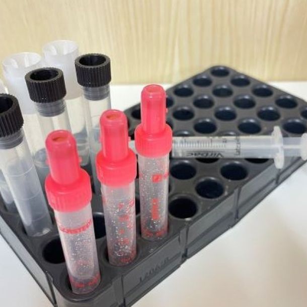 Das Bild zeigt Labormaterial